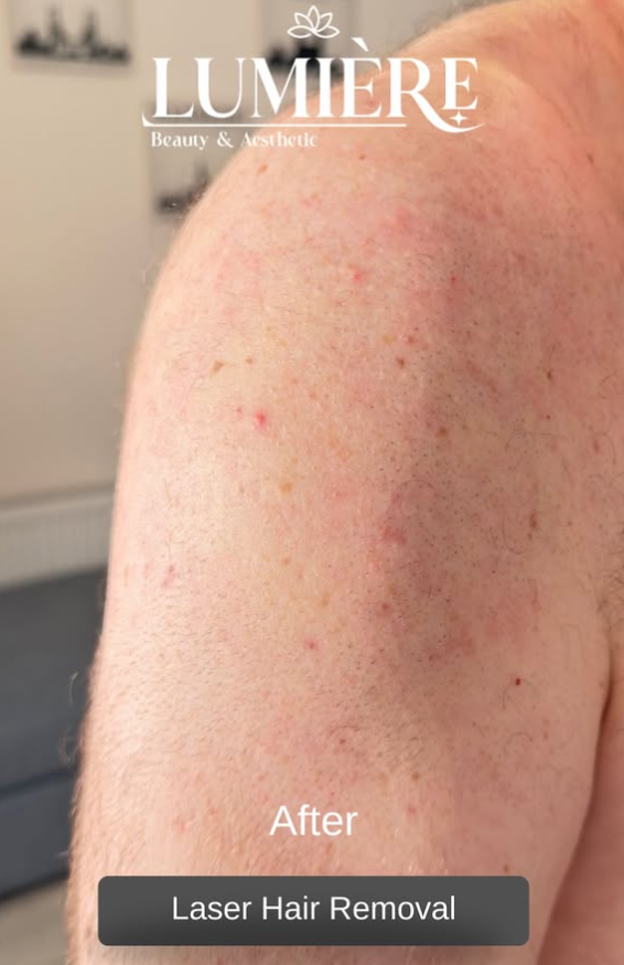 After treatment result