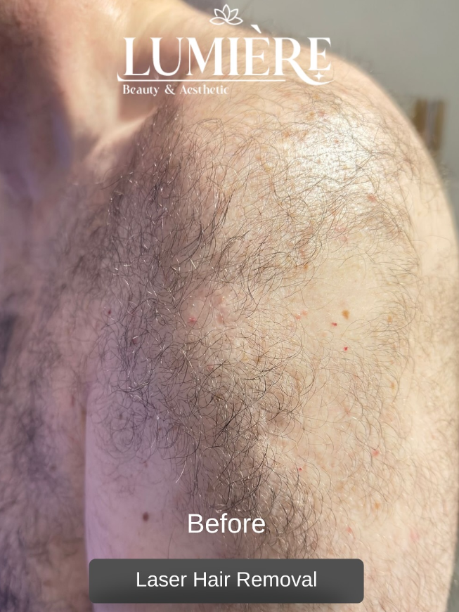 Before treatment result