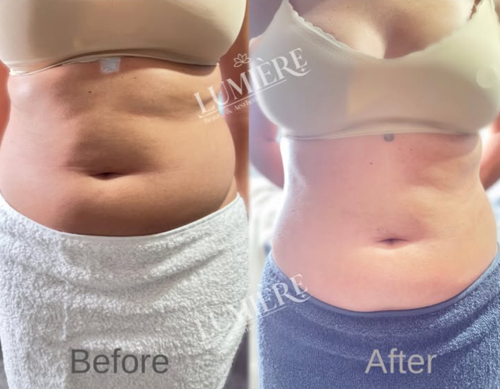 Before and after comparison
